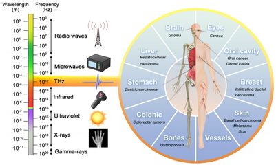 太赫兹医学成像 从体外到体内——技术演进与应用前景